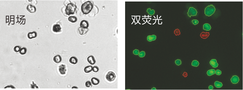 K2-Hepatocyte pic.png K2-Hepatocyte pic.png